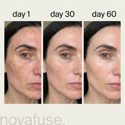 Novafuse MicroInfusion Serum